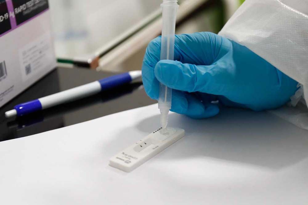 Prueba diagnóstica antígenos SARS-COV-2